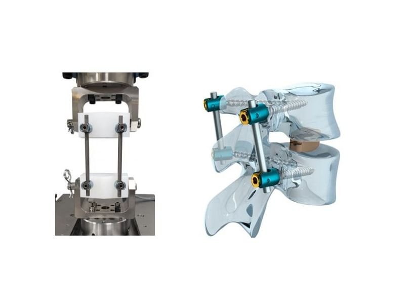 Резонансная машина МРМ 2.jpg