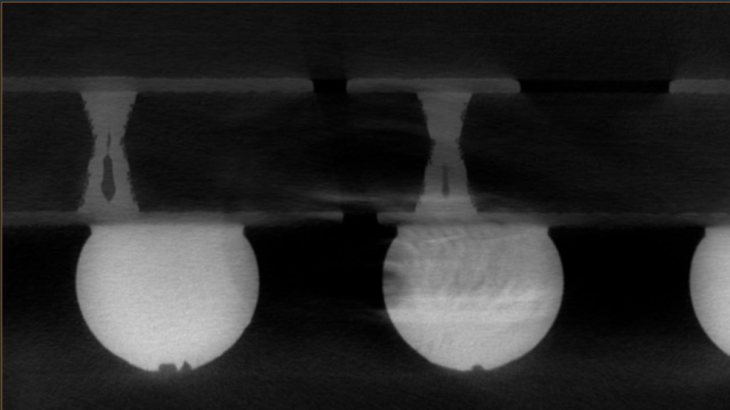 CT изображение